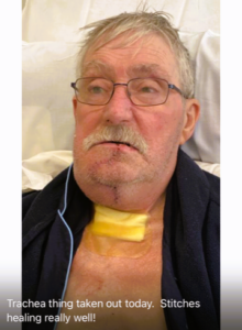 Danny O'Hanlon - Patient Story - Shortly after Op